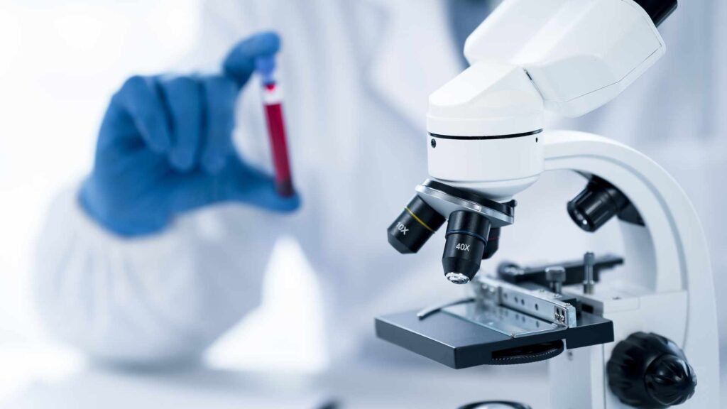 pTau Blood Testing for Alzheimers