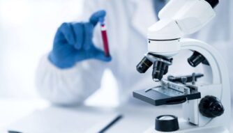 blood test for amyloid beta ratio